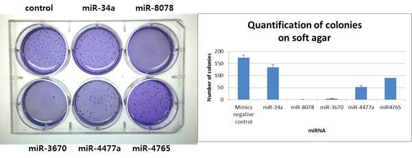 miRNA 에 의한 soft agar 에서의 폐암 세포주의 군집형성 능력 평가