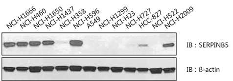 폐암 세포주별 SERPINB5 단백질 발현량 분석