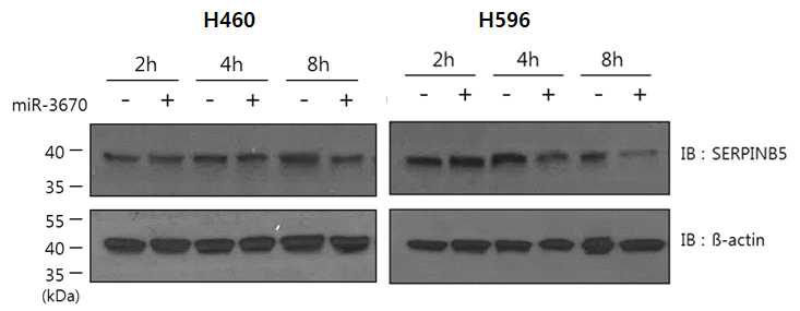 miR-3670 처리에 따른 SERPINB5 단백질 발현량 변화 측정