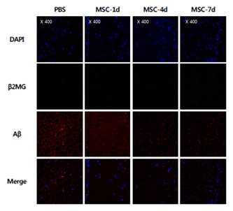 제대혈 유래 간엽줄기세포의 추적 및 아밀로이드 베타 면역 조직염색법 결과