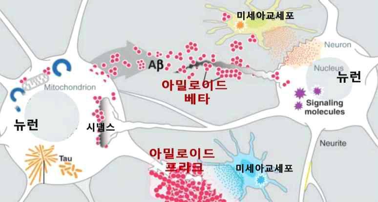 아밀로이드 베타에 의한 신경계 염증 환경에서 미세아교세포의 아밀로이드 베타 조절 역할