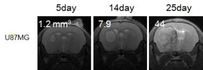 뇌종양 동물모델의 tumor growth 측정(MRI image)