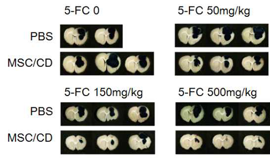 5-FC 농도에 따른 뇌종양 유전자세포치료제 효과