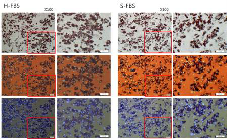 FBS 종류에 따른 뇌종양 유전자세포치료제의 지방세포로의 분화능