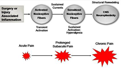 Transition from acute to chronic pain