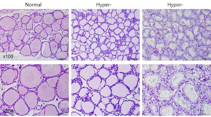 갑상선 기능항진증 (Hyper-) 및 저하증 (Hypo-) 흰쥐 모델에서 갑상선 조직의 변화(H&E stain)