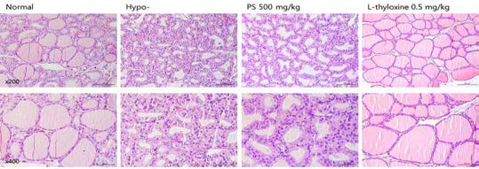 갑상선기능저하증(Hypo-) 흰쥐 모델에서 한성약인 하고초추출물(PS)의 갑상선 조직 변화(H&E stain)에 대한 효능평가