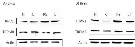 갑상선기능저하증(Hypo-) 흰쥐 모델에서 한성약인 하고초추출물(PS)의 DRG와 뇌 조직에서 온도감수성 일시적 전위통로(TRP) 단밸질 변화에 대한 효능 평가(Western blot)