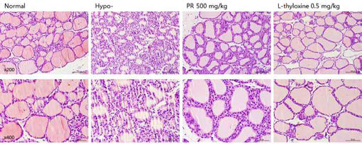 갑상선기능저하증(Hypo-) 흰쥐 모델에서 한성약인 갈근추출물(PR)의 갑상선 조직 변화(H&E stain)에 대한 효능평가