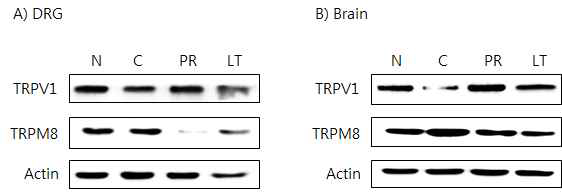 갑상선기능저하증(Hypo-) 흰쥐 모델에서 한성약인 갈근추출물(PR)의 DRG와 뇌 조직에서 온도감수성 일시적 전위통로(TRP) 단밸질 변화에 대한 효능 평가(Western blot)