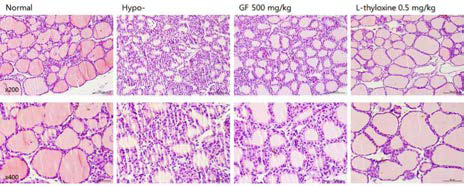 갑상선기능저하증(Hypo-) 흰쥐 모델에서 한성약인 치자추출물(GF)의 갑상선 조직 변화(H&E stain)에 대한 효능평가