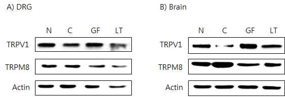 갑상선기능저하증(Hypo-) 흰쥐 모델에서 한성약인 치자추출물(GF)의 DRG와 뇌 조직에서 온도감수성 일시적 전위통로(TRP) 단밸질 변화에 대한 효능 평가(Western blot)