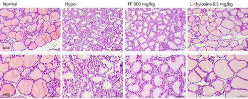 갑상선기능저하증(Hypo-) 흰쥐 모델에서 한성약인 연교추출물(FF)의 갑상선 조직 변화(H&E stain)에 대한 효능평가