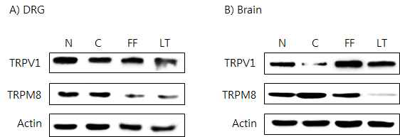 갑상선기능저하증(Hypo-) 흰쥐 모델에서 한성약인 연교추출물(FF)의 DRG와 뇌 조직에서 온도감수성 일시적 전위통로(TRP) 단밸질 변화에 대한 효능 평가(Western blot)