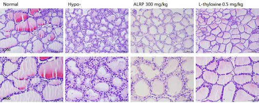 갑상선기능저하증(Hypo-) 흰쥐 모델에서 열성약인 포부자추출물(ALRP)의 갑상선 조직 변화(H&E stain)에 대한 효능평가