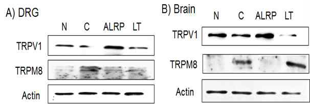 갑상선기능저하증(Hypo-) 흰쥐 모델에서 열성약인 포부자추출물(ALRP)의 DRG와 뇌 조직에서 온도감수성 일시적 전위통로(TRP) 단밸질 변화에 대한 효능 평가(Western blot)