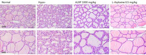 갑상선기능저하증(Hypo-) 흰쥐 모델에서 열성약인 포부자추출물(ALRP)의 갑상선 조직 변화(H&E stain)에 대한 효능평가