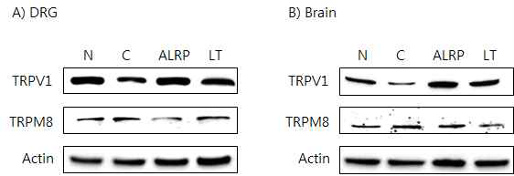 갑상선기능저하증(Hypo-) 흰쥐 모델에서 열성약인 포부자추출물(ALRP)의 DRG와 뇌 조직에서 온도감수성 일시적 전위통로(TRP) 단밸질 변화에 대한 효능 평가 (Western blot)