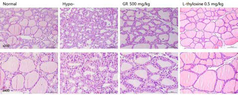 갑상선기능저하증(Hypo-) 흰쥐 모델에서 열성약인 인삼추출물(GR)의 갑상선 조직 변화(H&E stain)에 대한 효능평가