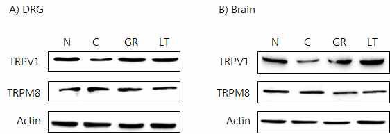 갑상선기능저하증(Hypo-) 흰쥐 모델에서 열성약인 인삼추출물(GR)의 DRG와 뇌 조직에서 온도감수성 일시적 전위통로 (TRP) 단밸질 변화에 대한 효능 평가 (Western blot)