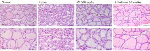 갑상선기능저하증(Hypo-) 흰쥐 모델에서 열성약인 건강추출물(ZR)의 갑상선 조직 변화(H&E stain)에 대한 효능평가