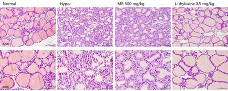 갑상선기능저하증(Hypo-) 흰쥐 모델에서 열성약인 파극천추출물(MR)의 갑상선 조직 변화(H&E stain)에 대한 효능평가