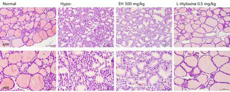갑상선기능저하증(Hypo-) 흰쥐 모델에서 열성약인 음양곽추출물(EH)의 갑상선 조직 변화(H&E stain)에 대한 효능평가