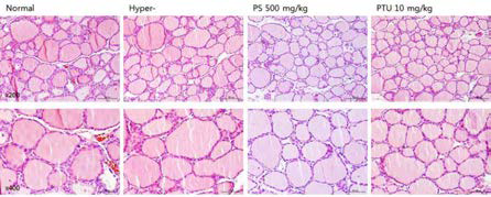 갑상선기능항진증(Hyper-) 흰쥐모델에서 한성약인 하고초추출물 (PS)의 갑상선 조직 변화(H&E stain)에 대한 효능평가