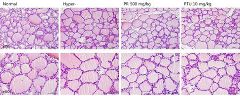 갑상선기능항진증(Hyper-) 흰쥐모델에서 한성약인 갈근추출물(PR)의 갑상선 조직 변화(H&E stain)에 대한 효능평가