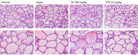 갑상선기능항진증(Hypo-) 흰쥐모델에서 한성약인 치자추출물(GF)의 갑상선 조직 변화(H&E stain)에 대한 효능평가