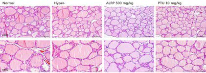 갑상선기능항진증(Hyper-) 흰쥐모델에서 열성약인 포부자추출물(ALRP)의 갑상선 조직 변화(H&E stain)에 대한 효능평가