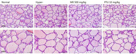 갑상선기능항진증(Hyper-) 흰쥐모델에서 열성약인 파극천추출물(MR)의 갑상선 조직 변화(H&E stain)에 대한 효능평가