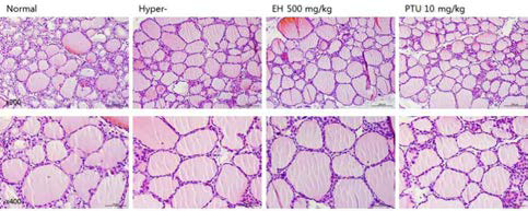 갑상선기능항진증(Hyper-) 흰쥐모델에서 열성약인 음양곽추출물(EH)의 갑상선 조직 변화(H&E stain)에 대한 효능평가