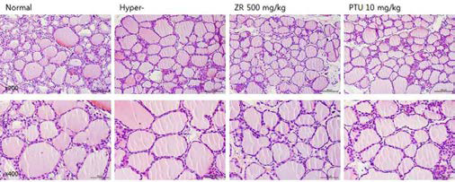 갑상선기능항진증(Hyper-) 흰쥐모델에서 열성약인 건강추출물(ZR)의 갑상선 조직 변화(H&E stain)에 대한 효능평가