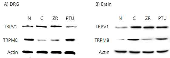 갑상선기능항진증(Hyper-) 흰쥐모델에서 열성약인 건강추출물(ZR)의 DRG와 뇌 조직에서 온도감수성 일시적 전위통로(TRP) 단밸질 변화에 대한 효능 평가 (Western blot)