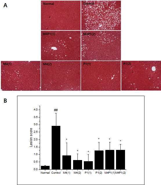 Inhibition of hepatic lipid accumulation by M, P and MP in high fat diet-fed obese C57BL/6N mice