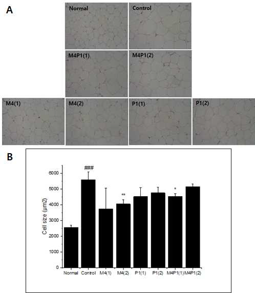 Histology of epididymal adipose tissue in high fat diet-fed obese C57BL/6N mice