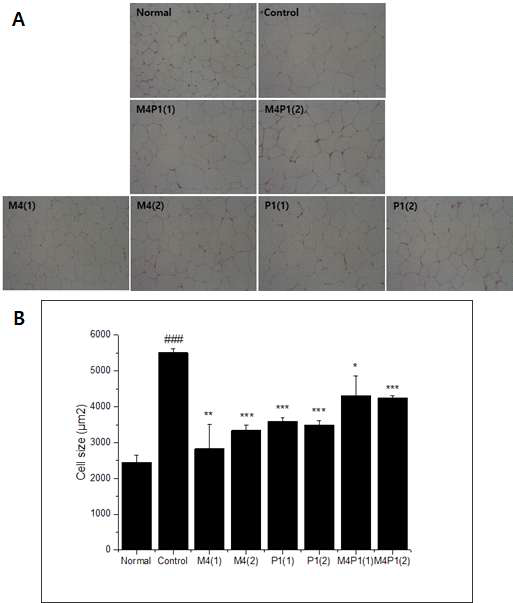 Histology of inguinal adipose tissue in high fat diet-fed obese C57BL/6N mice