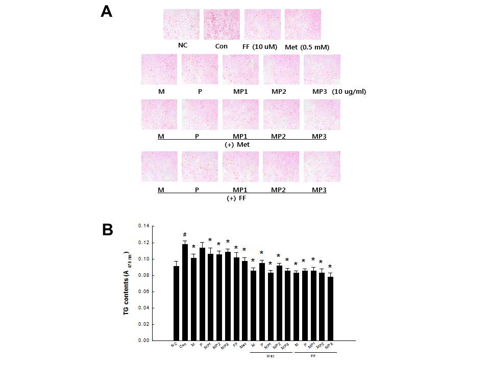 Effects of combinations of MIR components, metformin, and fenofibrate on lipid accumulation in HepG2 cells