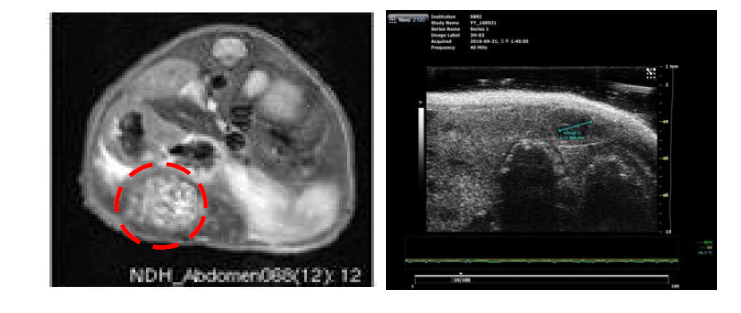 MRI와 초음파를 이용한 비장내 주입을 통한 간 조직 내 종양 형성 확인