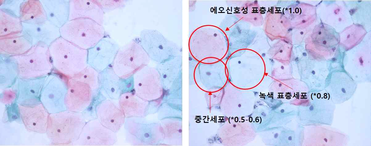 질성숙지수 평가를 위한 폐경 전 여성의 PAP staining 결과