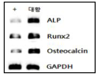 MC3T3-E1 세포주에서 대황(종대황) 추출물에 의한 조골세포 분화 표지 유전자 발현 조절(RT-PCR)
