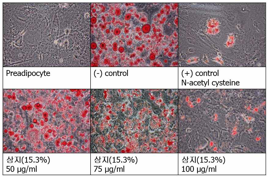 3T3-L1의 Lipid accumulation (Phase contrast microscope, 400배).