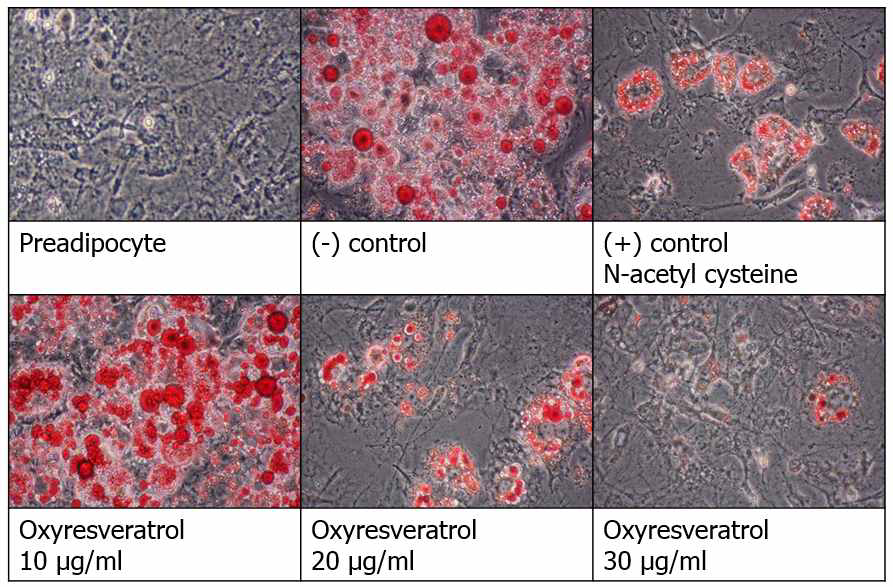 3T3-L1의 Lipid accumulation (Phase contrast microscope, 400배).