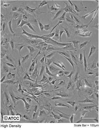 3T3-L1 cell line.