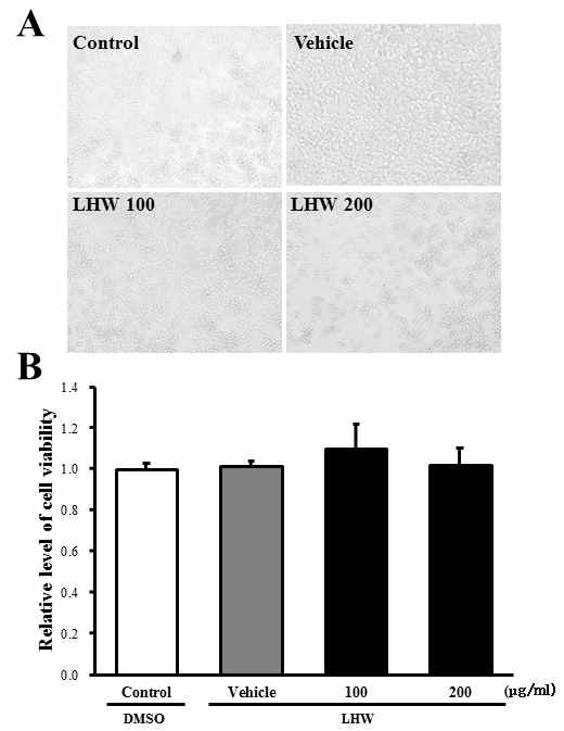 Effects of extraction of A. cochinchinensis (LHW) on cytotoxicity in RAW264.7 cells.