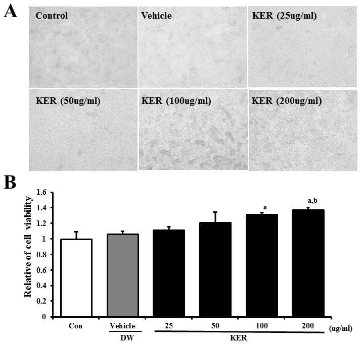 Effects of extraction of A. cochinchinensis (KER) on cytotoxicity in RAW264.7 cells