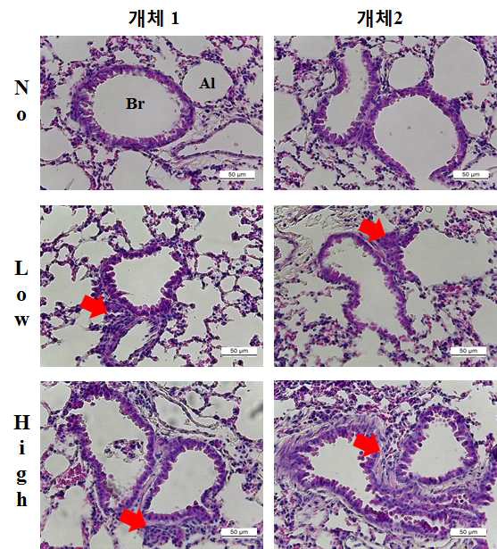 Histological structure of lung in balb/c mice after inhalation.