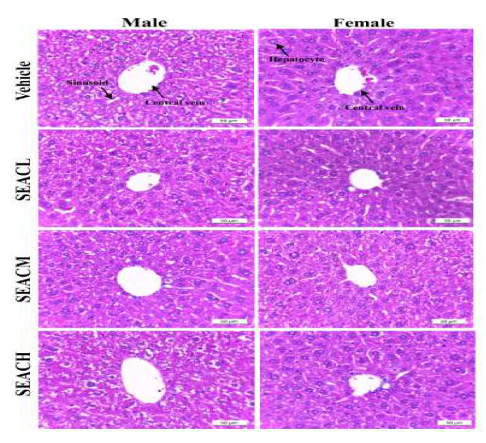 Effects of SEAC on liver toxicity in ICR mice. Liver tissues of male and female ICR mice were stained with H&E and histological structure was viewed at 400× magnification.