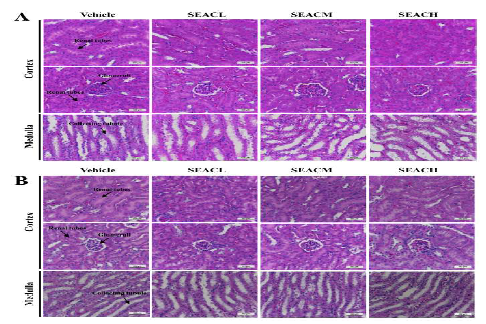 Effects of SEAC on the kidney toxicity in ICR mice.